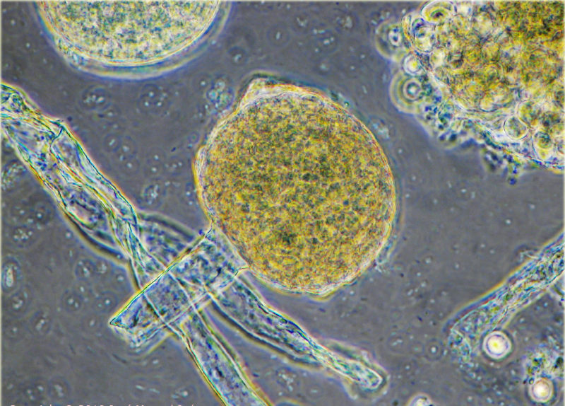 hongos microscopicos